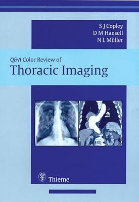 Thoracic Imaging: Self-assessment Color Review (Q&a Color Review) | Paperback