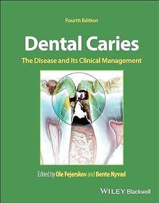 Dental Caries: The Disease and Its Clinical Management | Hardcover | Medical
