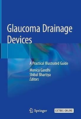 Glaucoma Drainage Devices: A Practical Illustrated Guide | Hardcover | Ophthalmology
