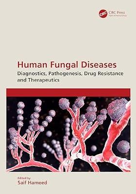 Human Fungal Diseases: Diagnostics, Pathogenesis, Drug Resistance and Therapeutics | Hardcover | Infectious And Contagious Diseases