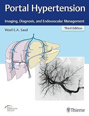 Portal Hypertension: Imaging, Diagnosis, and Endovascular Management by Saad | Hardcover | Medical