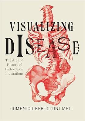 Visualizing Disease – The Art and History of Pathological Illustrations by Bertoloni Meli, Domenico | Hardcover | Biology