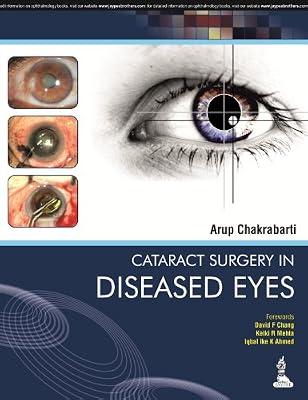 Cataract Surgery in Diseased Eyes by Chakrabarti Arup | Hardcover | Ophthalmology