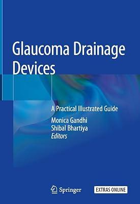 Glaucoma Drainage Devices: A Practical Illustrated Guide | Hardcover | Ophthalmology 2