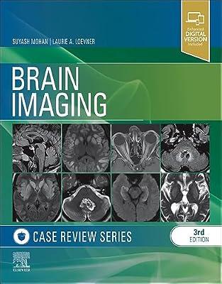 Brain Imaging: Case Review Series by Loevner MD, Laurie A.; Mohan MD, Suyash | Paperback | Medical