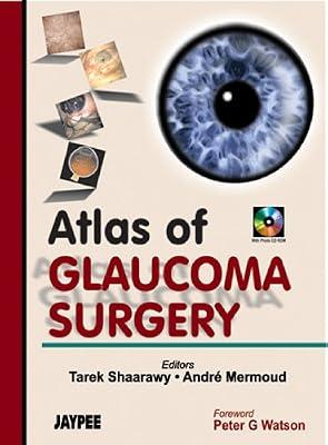 Atlas of Glaucoma Surgery with Photo CD-ROM by Shaarway | Hardcover | Ophthalmology