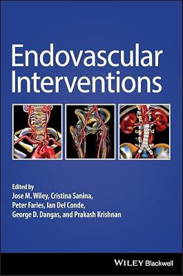 ENDOVASCULAR INTERVENTIONS (HB 2019) by WILEY | Hardcover | Medical