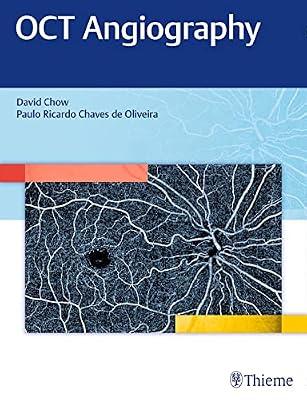 OCT Angiography by Chow | Hardcover | Ophthalmology