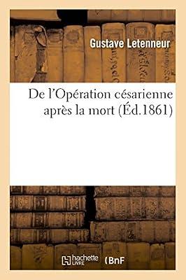 de l'Opération Césarienne Après La Mort by Letenneur-G | Paperback | History Of Medicine