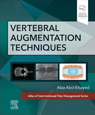 Vertebral Augmentation Techniques (Atlas of Interventional Pain Management) | Hardcover | Pain & Pain Management