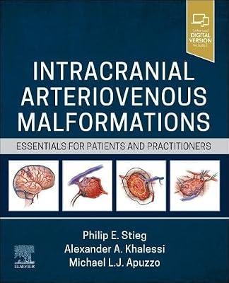 Intracranial Arteriovenous Malformations: Essentials for Patients and Practitioners | Hardcover | Neurosurgery