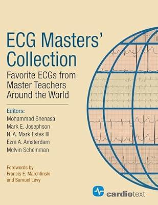 ECG Masters Collection: Favorite ECGs from Master Teachers Around the World by Shenasa, Mohammad, M.D.; Josephson, Mark E., M.D.; Estes, N. A. Mark, III | Paperback | Medical