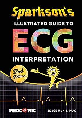 Sparkson's Illustrated Guide to ECG Interpretation, 2nd Edition by Muniz, Jorge | Paperback | Medical Imaging