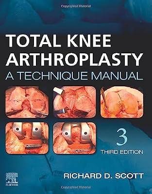 TOTAL KNEE ARTHROPLASTY A TECHNIQUE MANUAL WITH ACCESS CODE 3ED (HB 2021) by Scott MD, Richard D. | Hardcover | Medical
