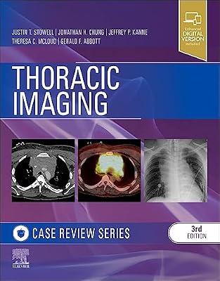 THORACIC IMAGING CASE REVIEW WITH ACCESS CODE 3ED (PB 2024) by Stowell MD, Justin T.; Chung MD, Jonathan H.; Kanne MD  FCCP, Jeffrey P; Abbott MD, Gerald F.; McLoud MD, Theresa C. | Paperback | Medical