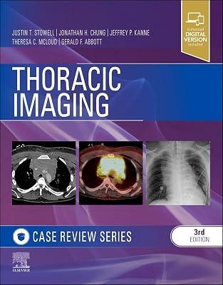 THORACIC IMAGING CASE REVIEW WITH ACCESS CODE 3ED (PB 2024) by Stowell MD, Justin T.; Chung MD, Jonathan H.; Kanne MD  FCCP, Jeffrey P; Abbott MD, Gerald F.; McLoud MD, Theresa C. | Paperback | Medical 2