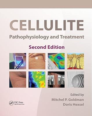 Cellulite: Pathophysiology and Treatment (Basic and Clinical Dermatology, 45) | Paperback | Dermatology 2