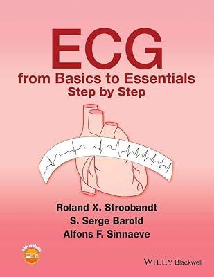 Ecg From Basics To Essentials Step By Step (Pb 2016) by STROOBANDT R X | Paperback | Medical 2