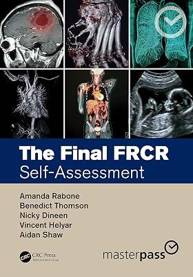 The Final FRCR: Self-Assessment (MasterPass) by Dineen, Nicky; Thomson, Benedict; Helyar, Vincent; Shaw, Aidan; Rabone, Amanda | Paperback | Medical Imaging: Radiology 2