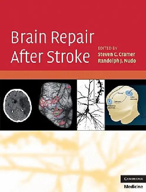Brain Repair After Stroke (English, Steven C. Cramer | Randolph J. Nudo)