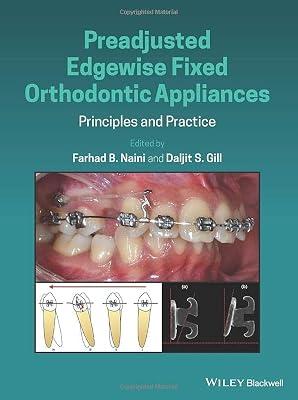 Preadjusted Edgewise Fixed Orthodontic Appliances: Principles and Practice | Hardcover | Medical 2