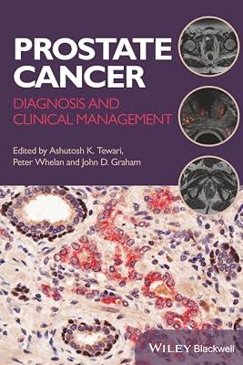 Prostate Cancer: Diagnosis And Clinical Management (Pb 2014) | Paperback | Medical 2