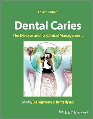 Dental Caries: The Disease and Its Clinical Management | Hardcover | Medical 2