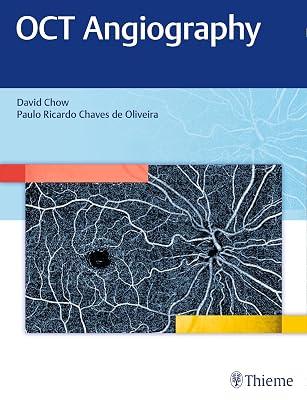 OCT Angiography by Chow | Hardcover | Ophthalmology 2
