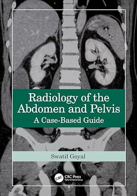 Radiology of the Abdomen and Pelvis: A Case-Based Guide by Goyal, Swati | Hardcover | Medical Imaging: Radiology 2