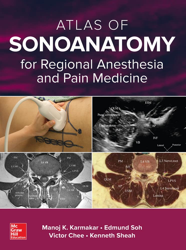 Buy Atlas of Sonoanatomy for Regional Anesthesia and Pain Medicine (English, Paperback, Manoj Karmakar) Online at Best Price - GlowMirror