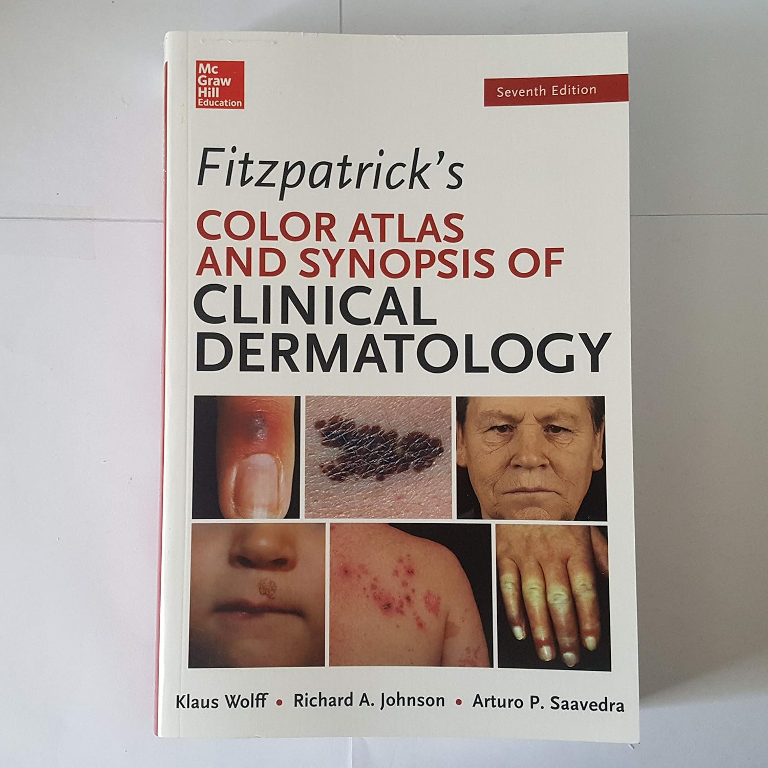 Buy Fitzpatrick's Color Atlas And Synopsis Of Clinical Dermatology (English, Paperback, Klaus Wolff, Richard Johnson, Arturo Saavedra) Online at Best Price - GlowMirror