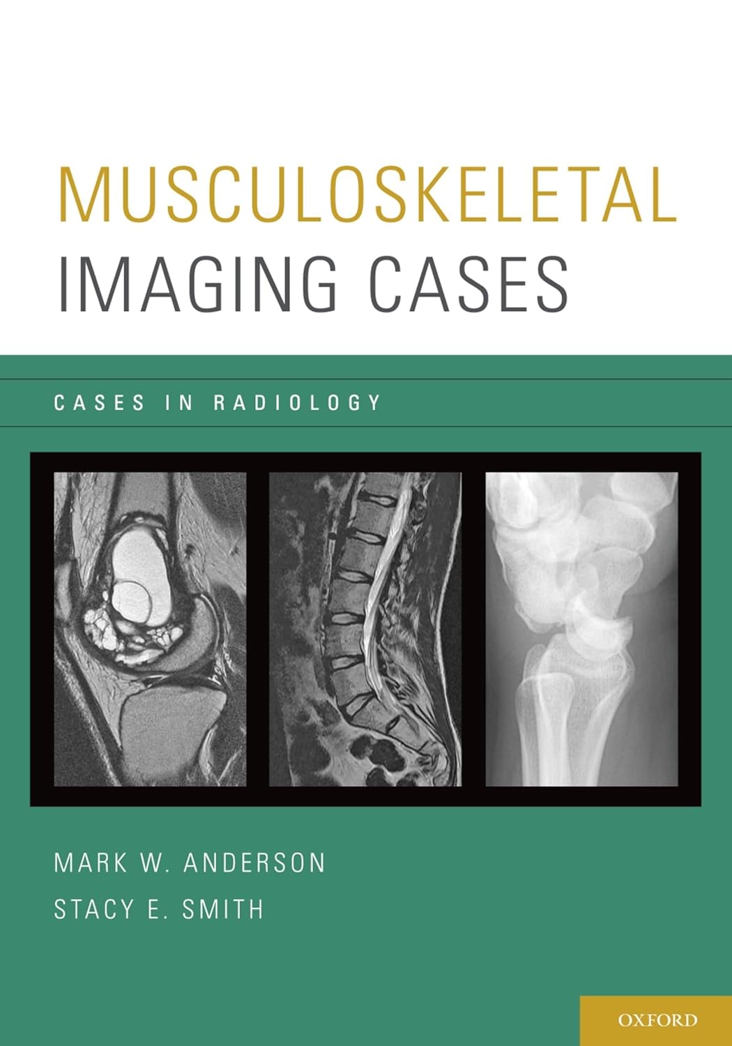 Musculoskeletal Imaging Cases (Cases In Radiology) (English, Paperback, Mark W. Anderson, Stacy E. Smith) - Image 1 - GlowMirror