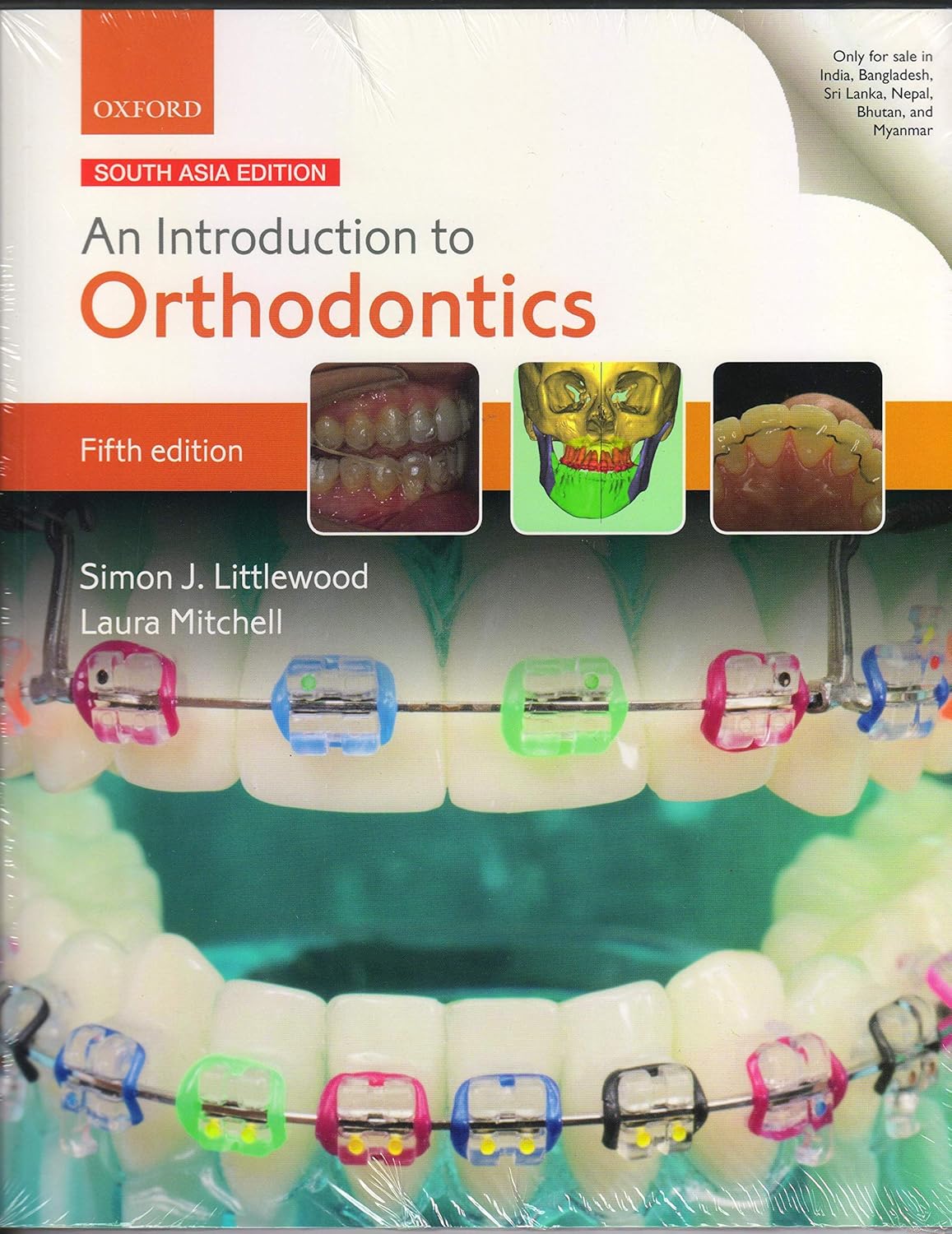 Buy An Introduction to Orthodontics (English, Paperback, Simon J. Littlewood and Laura Mitchell) Online at Best Price - GlowMirror