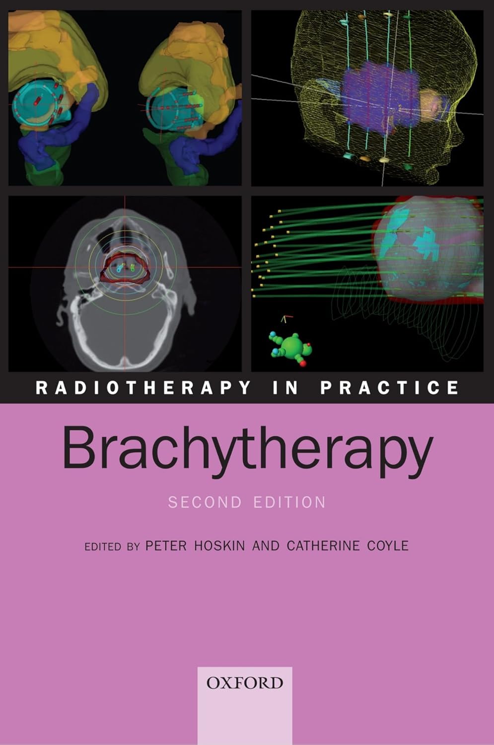 Radiotherapy in Practice - Brachytherapy (English, Paperback, Peter Hoskin, Catherine Coyle) - Image 1 - GlowMirror