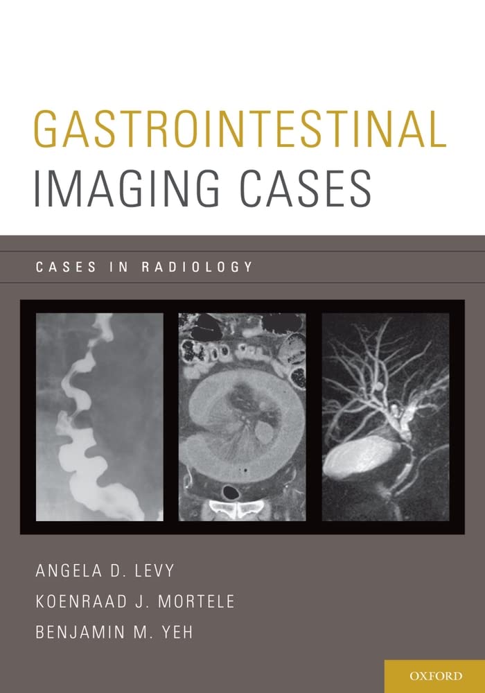 Buy Gastrointestinal Imaging Cases (Cases In Radiology) (English, Paperback, Angela D. Levy, Koenraad Mortele, Benjamin M. Yeh) Online at Best Price - GlowMirror