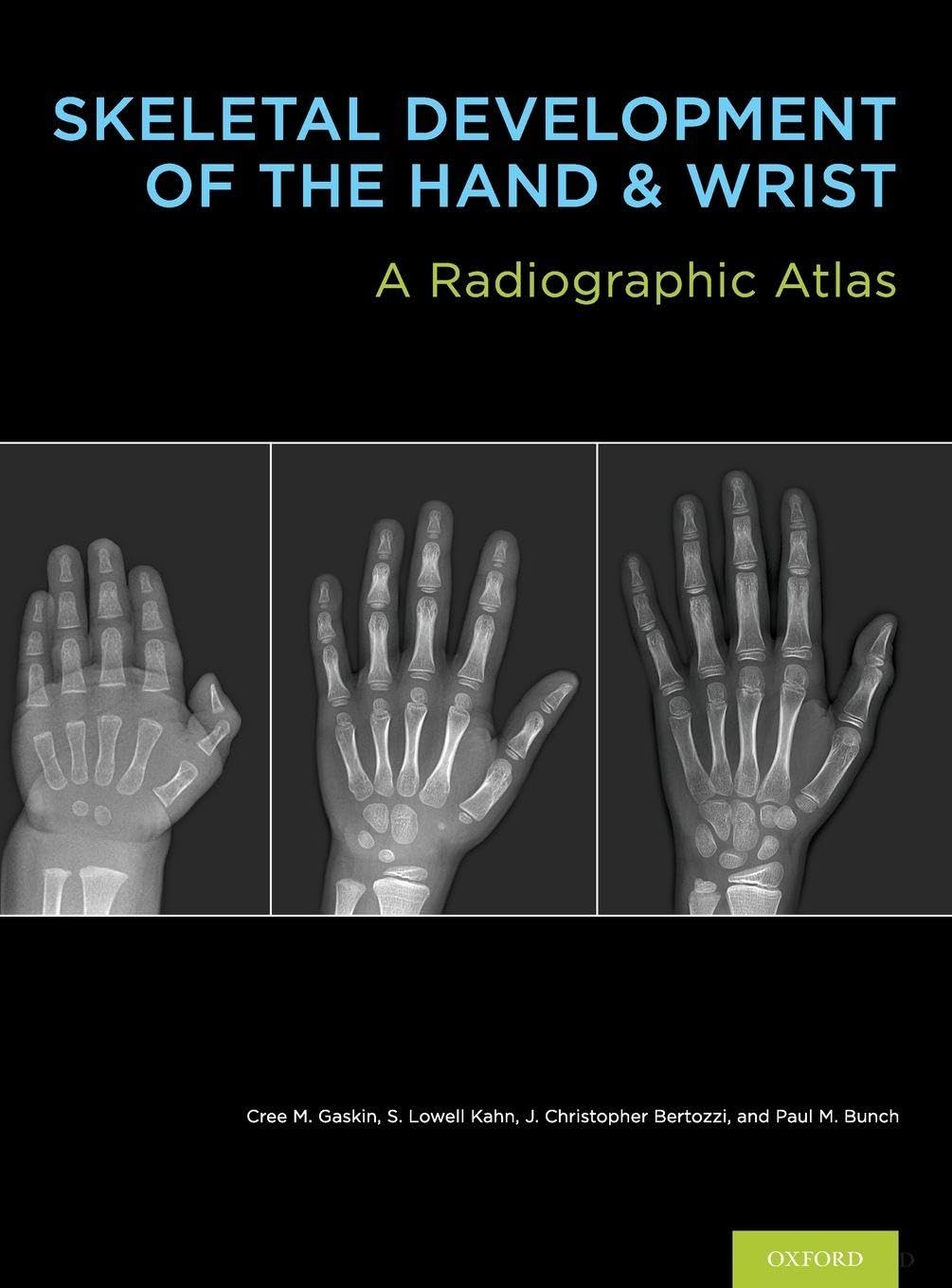 Buy Skeletal Development of the Hand and Wrist: A Radiographic Atlas and Digital Bone Age Companion (English, Paperback, M.D. Gaskin, Cree M., M.D. Kah... Online at Best Price - GlowMirror