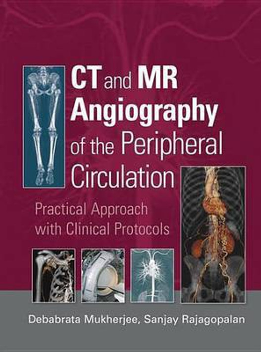 Buy CT and MR Angiography of the Peripheral Circulation (English, Paperback) Online at Best Price - GlowMirror