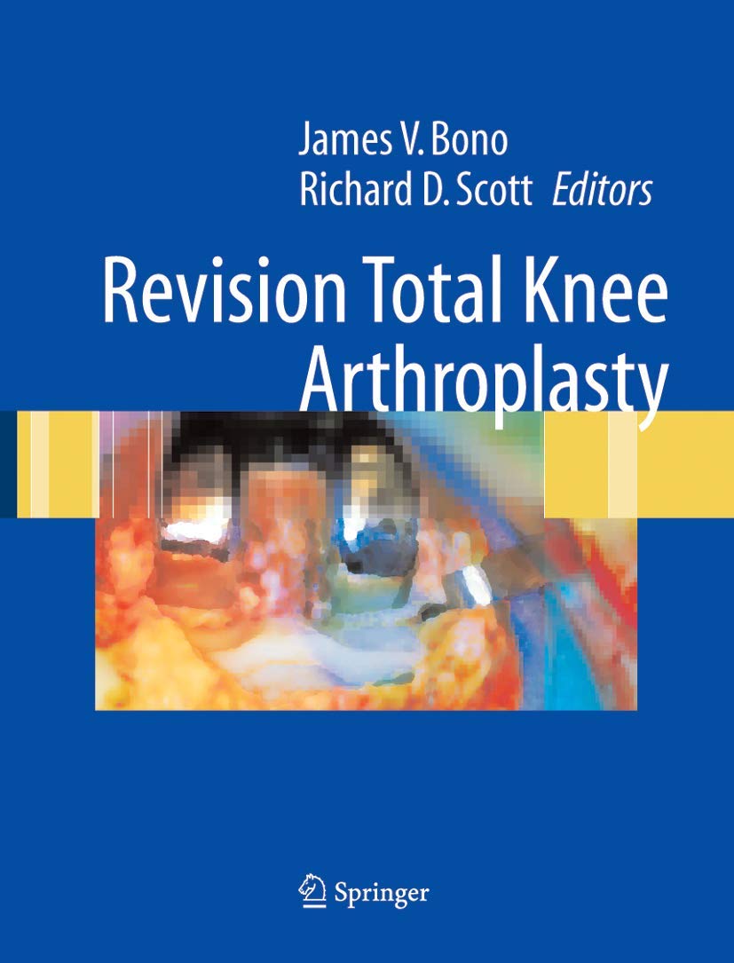 Buy Revision Total Knee Arthroplasty (English, Hardcover, Nono J.V.) Online at Best Price - GlowMirror