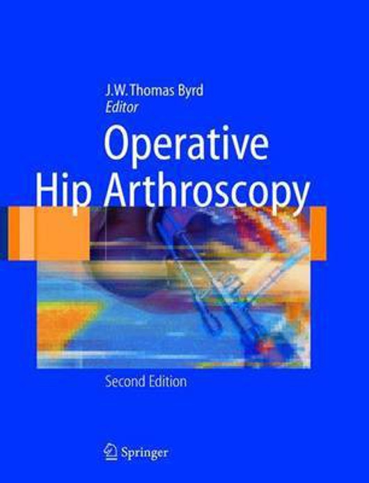 Buy Operative Hip Arthroscopy (English, Paperback) Online at Best Price - GlowMirror