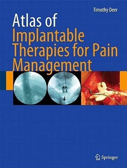 Buy Atlas of Implantable Therapies for Pain Management 1st Edition. Edition (English, Paperback) Online at Best Price - GlowMirror