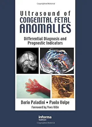 Buy Ultrasound of Congenital Fetal Anomalies (English, Hardcover, Dario Paladini, Paolo Volpe) Online at Best Price - GlowMirror