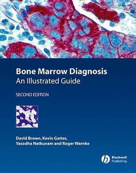 Bone Marrow Diagnosis (English, Paperback) - Image 1 - GlowMirror