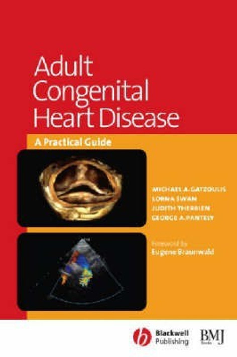Buy Adult Congenital Heart Disease (English, Paperback) Online at Best Price - GlowMirror