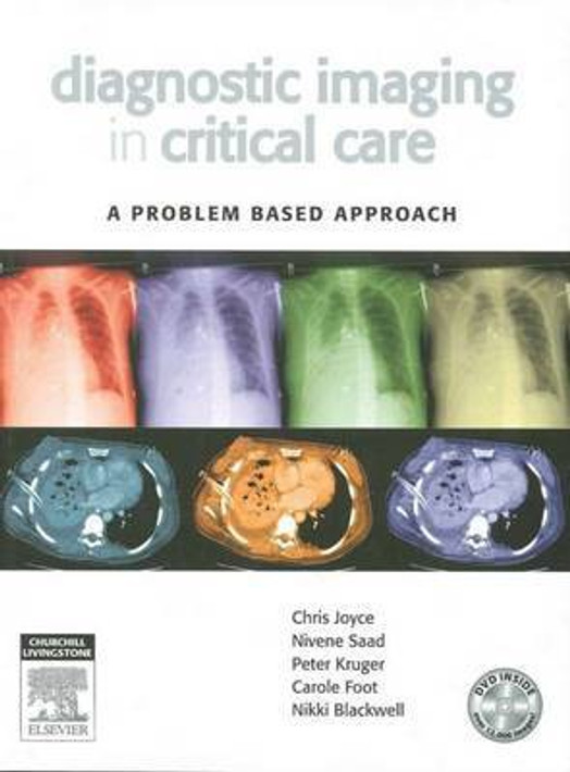 Buy Diagnostic Imaging in Critical Care - A Problem Based Approach (English, Paperback) Online at Best Price - GlowMirror