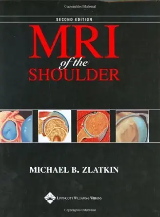 Buy MRI of the Shoulder (English, Hardcover, Michael B. Zlatkin) Online at Best Price - GlowMirror