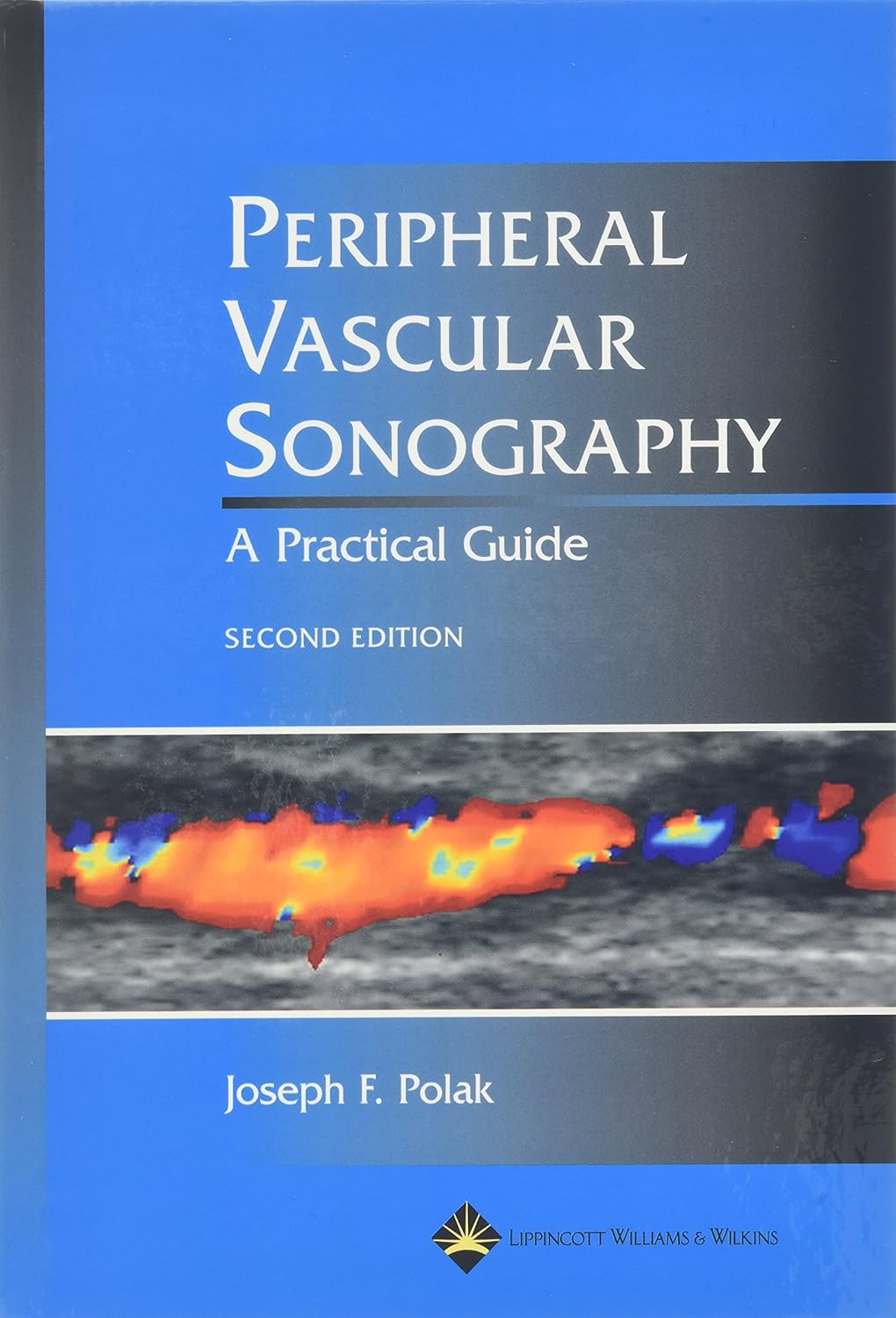 Buy Peripheral Vascular Sonography: A Practical Guide (English, Hardcover, Polak) Online at Best Price - GlowMirror
