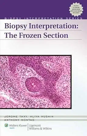 Buy Biopsy Interpretation The Frozen Section (Old) (Biopsy Interpretation Series) (English, Hardcover, Jerome B. Taxy, Aliya N. Husain, Anthony G. Montag) Online at Best Price - GlowMirror
