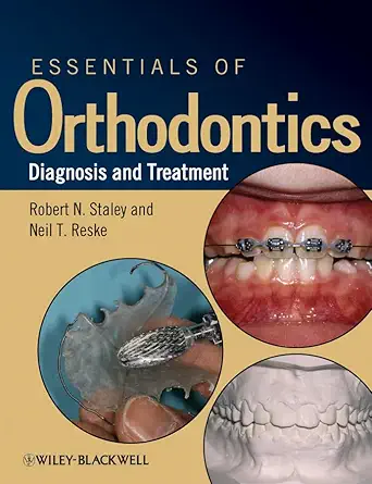 Buy Essentials of Orthodontics: Diagnosis and Treatment (English, Paperback, Robert N. Staley) Online at Best Price - GlowMirror