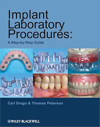 Buy Implant Laboratory Procedures: A Step–by–Step Guide (English, Paperback, Carl Drago, Thomas Peterson) Online at Best Price - GlowMirror