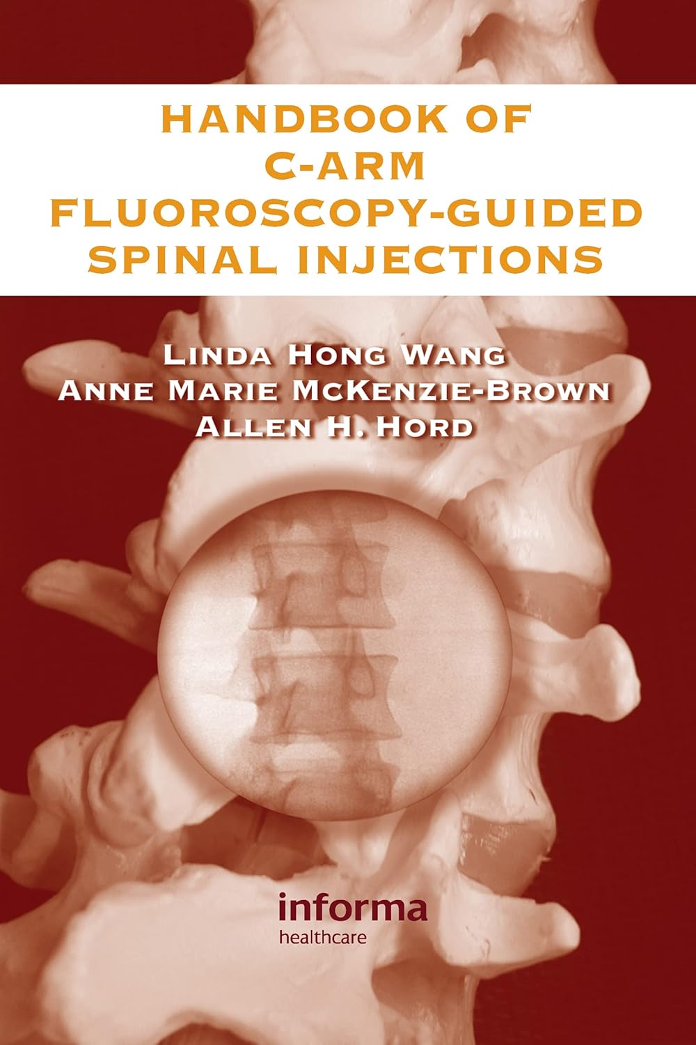 Buy Handbook Of C-Arm Fluoroscopy-Guided Spinal Injections (English, Paperback, Linda Hong Wang, Anne Marie McKenzie-Brown, Allen Hord) Online at Best Price - GlowMirror